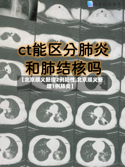 【北京顺义新增2例阳性,北京顺义新增1例肺炎】