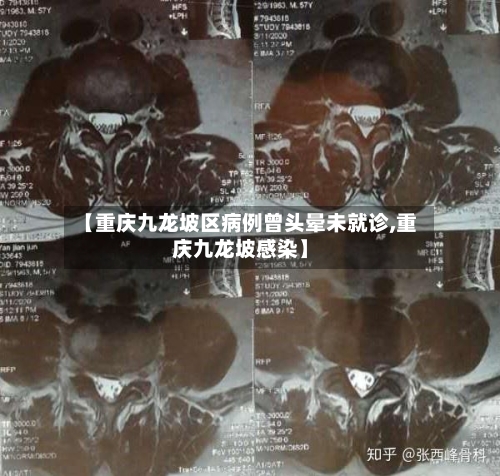 【重庆九龙坡区病例曾头晕未就诊,重庆九龙坡感染】-第3张图片